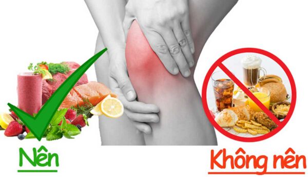 Bệnh nhân bị cơ xương khớp nên ăn gì và kiêng gì